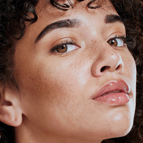 Lariette skincare pete pigmentare